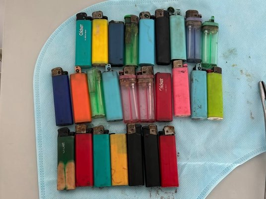 Зажигалки, извлеченные из желудка пациента Республиканской больницы №1 в Туве