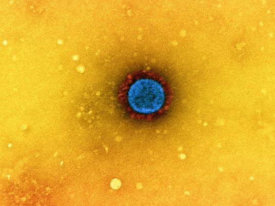 Коронавирус SARS-CoV-2 под микроскопом